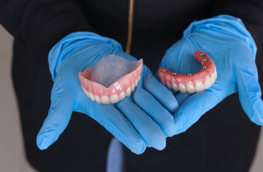quelle est la meilleure solution, un dentier amovible ou une prothèse sur 6 implants dentaires ?