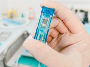 Implant dentaire Porto