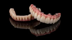 Chirurgie All-on-6 Portugal Porto