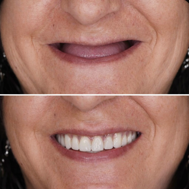 Implantologie dentaire porto