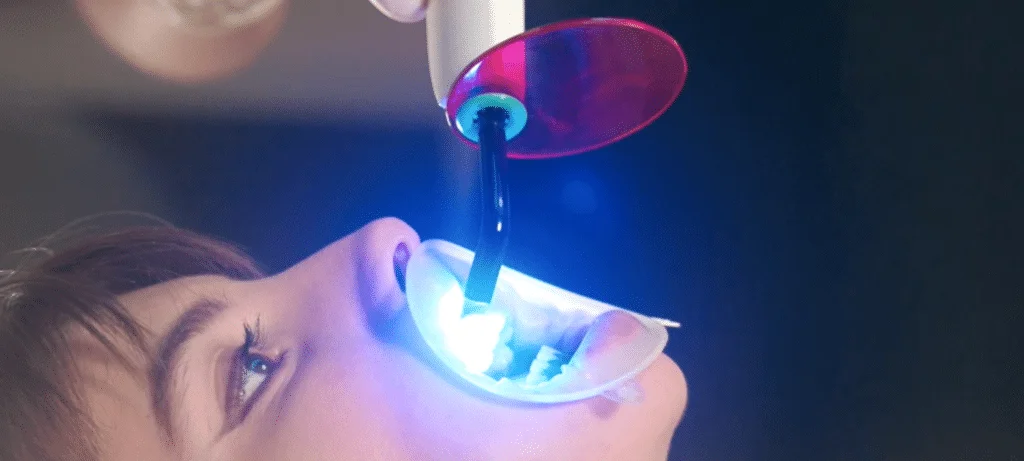 Blanchiment au fauteuil à porto