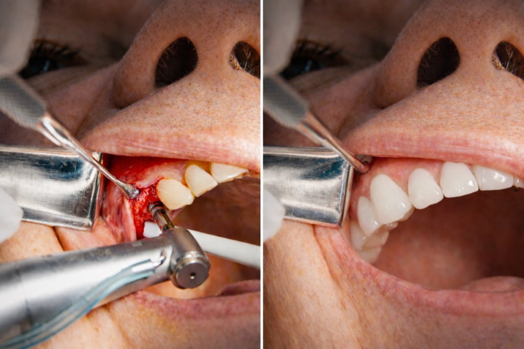 Dental tourism myths